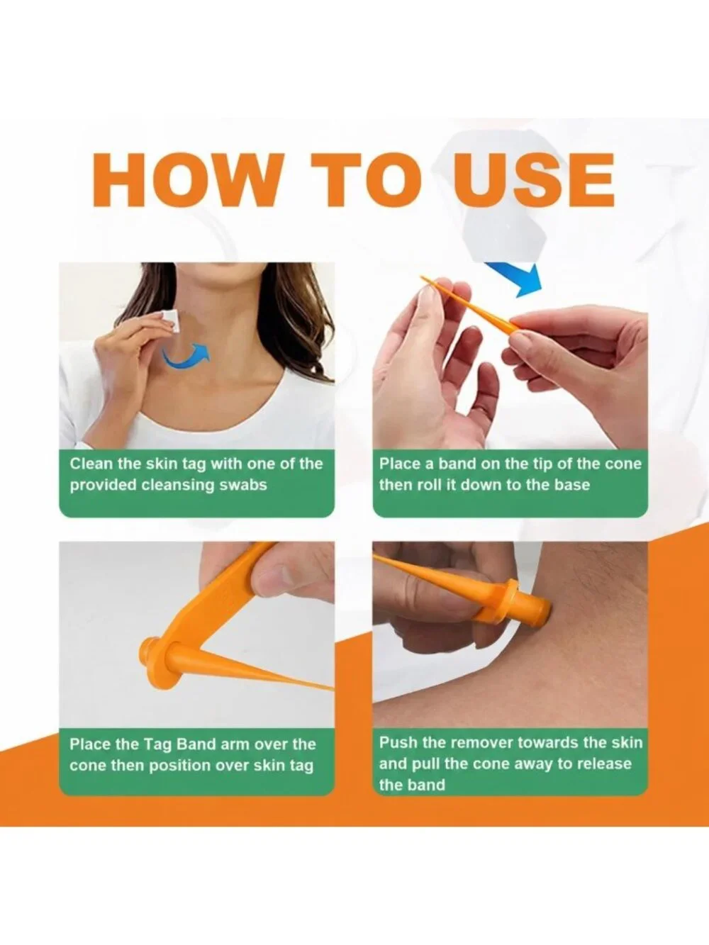 Effective Skin Tag Remover Kit - FDA-Cleared Device for Safe Home Use (Blue)